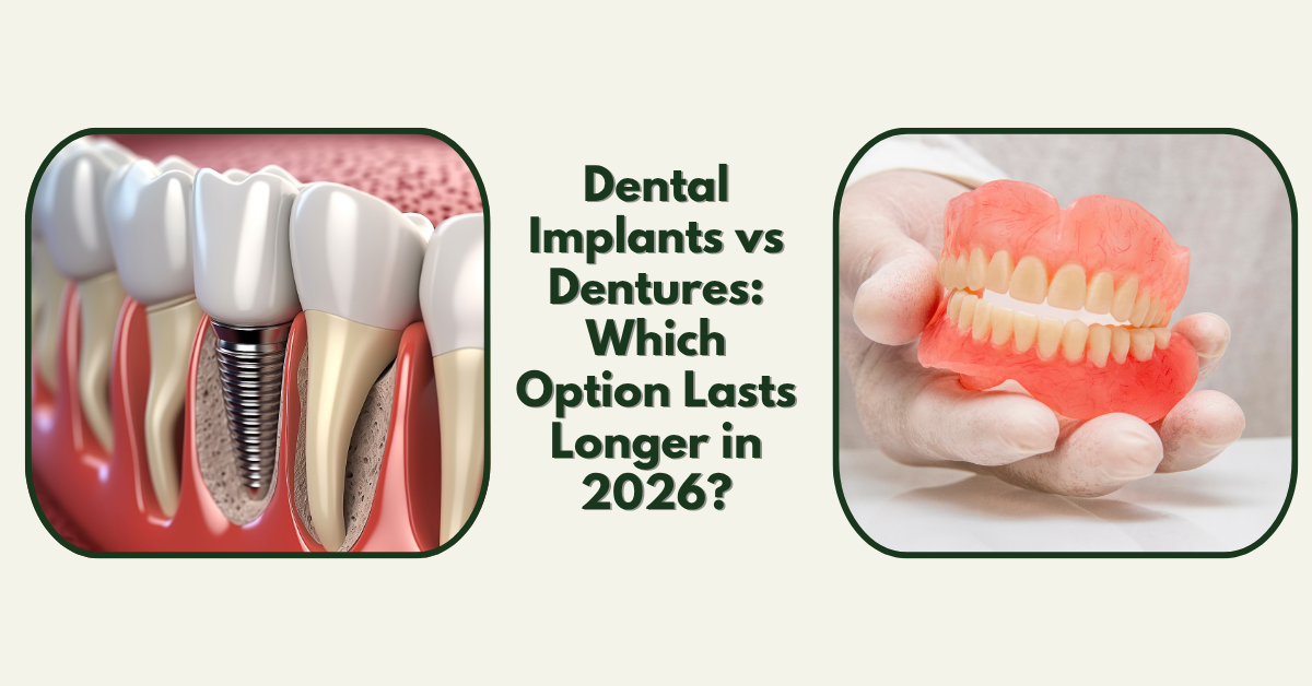 Dental Implants vs Dentures Which Option Lasts Longer in 2026