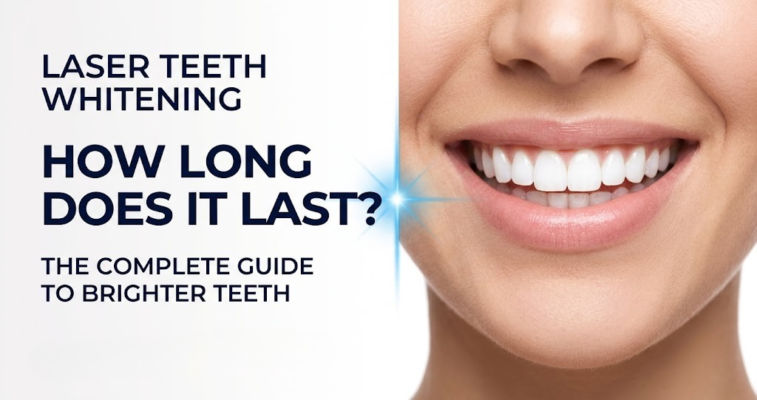 How Long Does Laser Teeth Whitening Last?