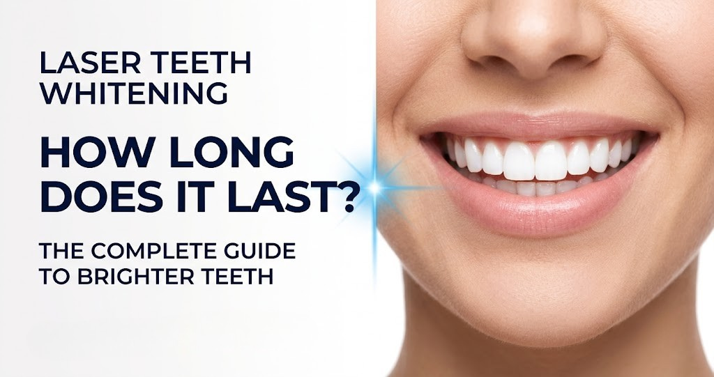 How Long Does Laser Teeth Whitening Last?